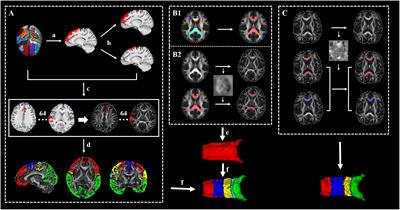 Longitudinal Macro/Microstructural Alterations of Different Callosal Subsections in Parkinson’s Disease Using Connectivity-Based Parcellation